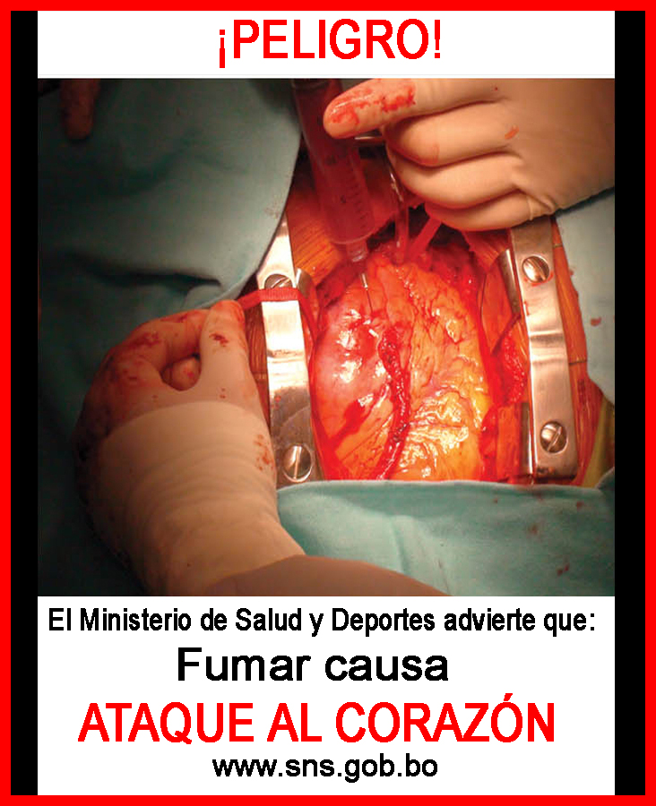 Bolivia 2011 Health Effects heart - heart attack, open heart, graphic